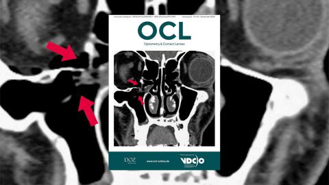 OCL Ausgabe 